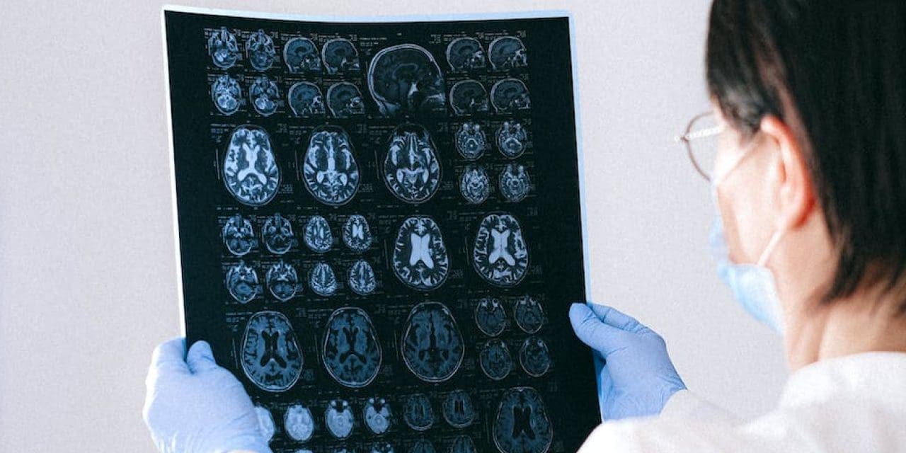 a doctor holding a brain scan result